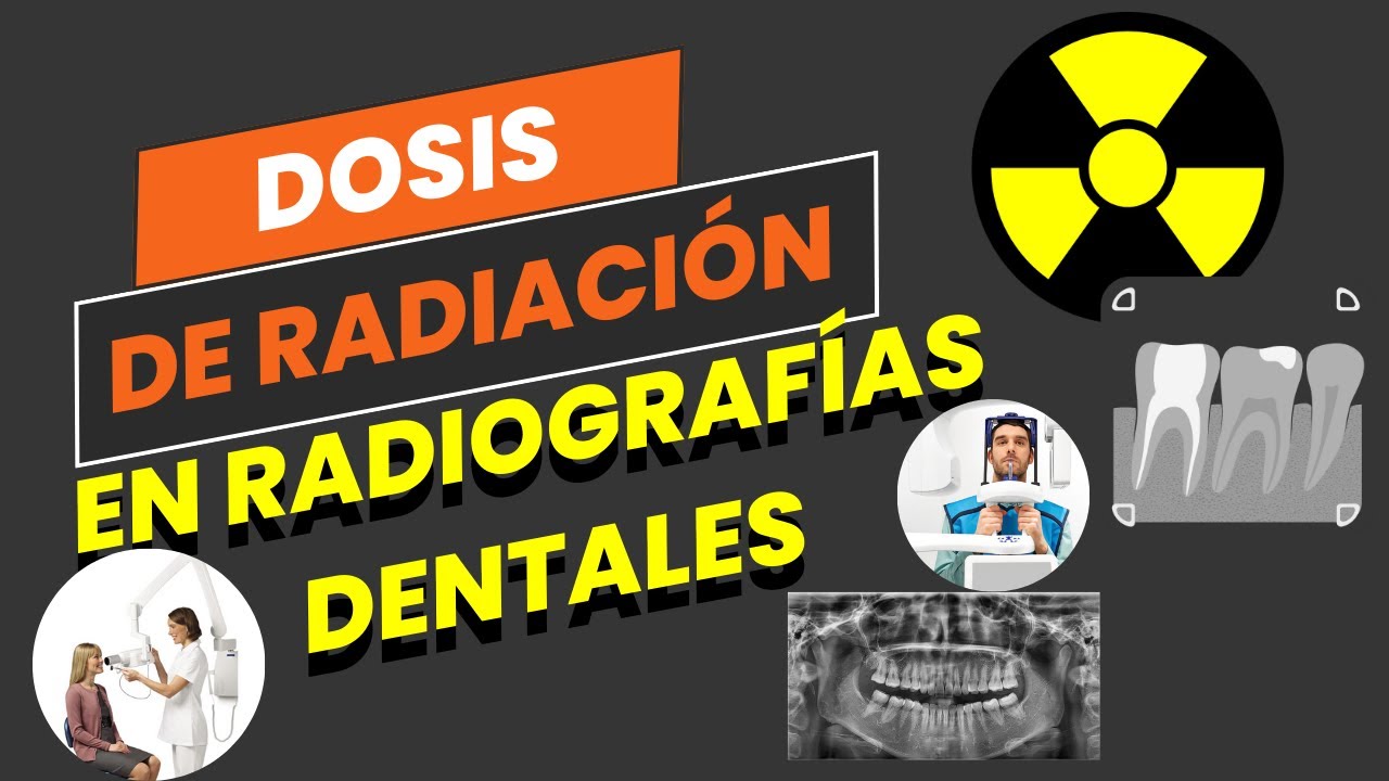 que dosis de radiacion se recibe en una radiografia