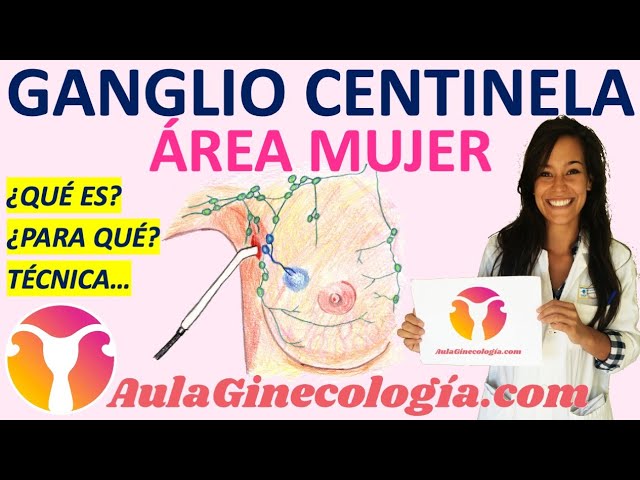 nodulos linfaticos de la mama